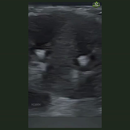 Suplemento Renal con Rápida Solución